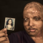 India's Best Portraiture Portrait Photographer Acid Attack